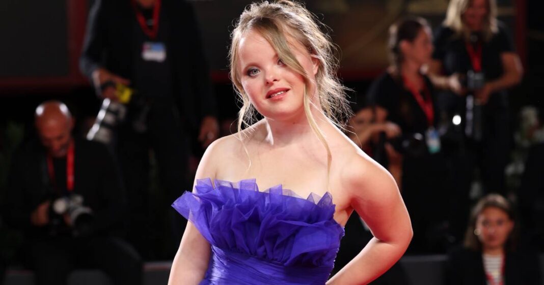  A model with Down syndrome parades during London Fashion Week, the temple of fashion |  Beauty

